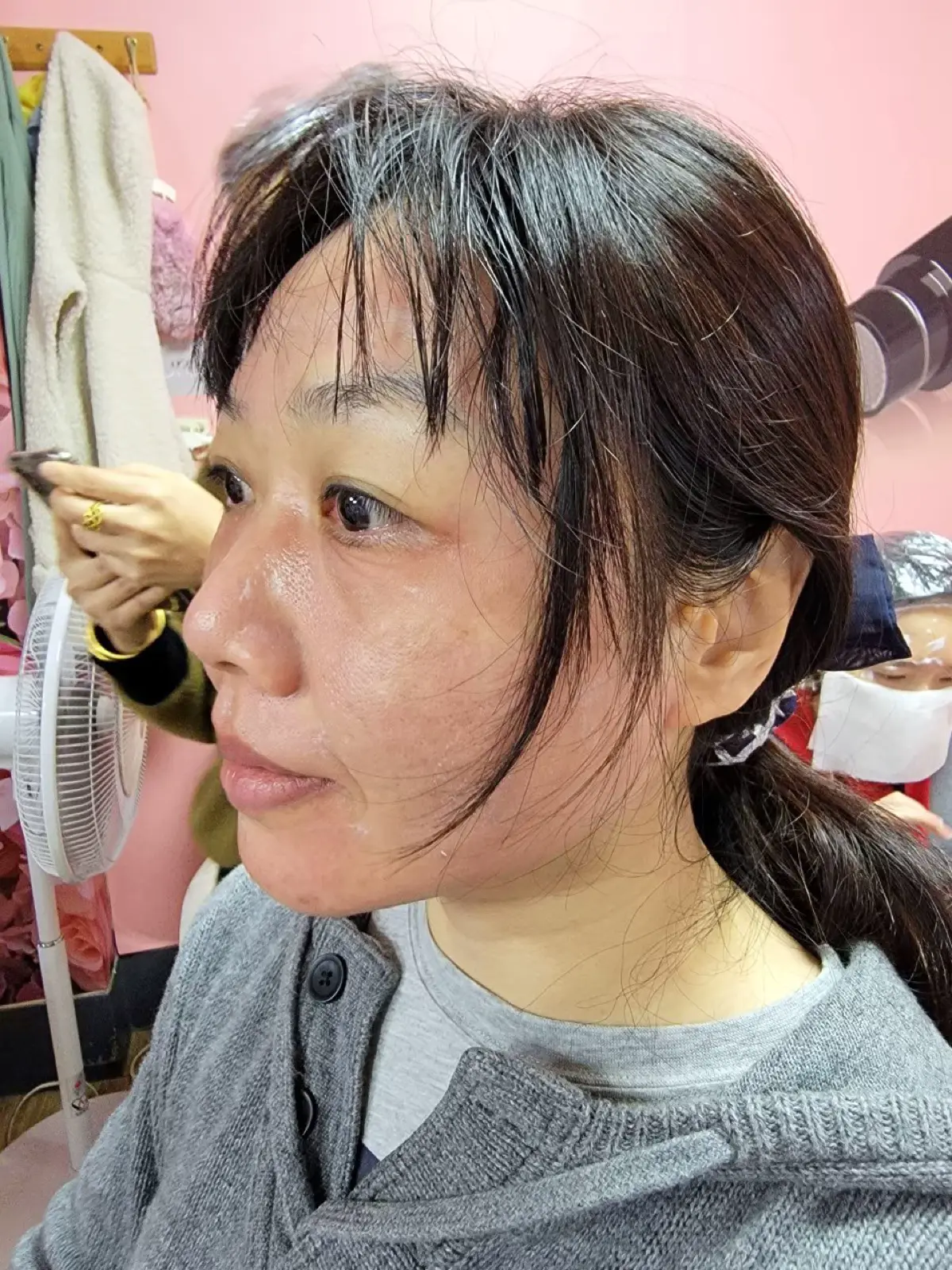 第一次皮秒雷射紀錄｜郭健軍皮膚科診所